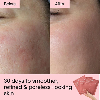 Bio Dance™ Collagen Glow Up Mask