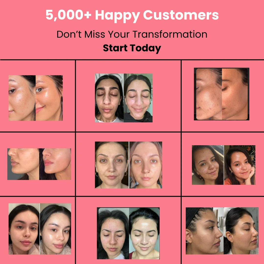 HOYGI™ Collagen Peal off Mask