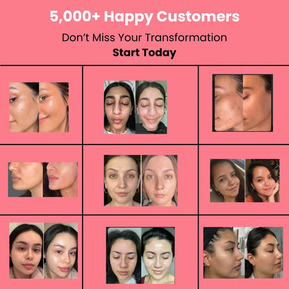 HOYGI™ Collagen Peal off Mask