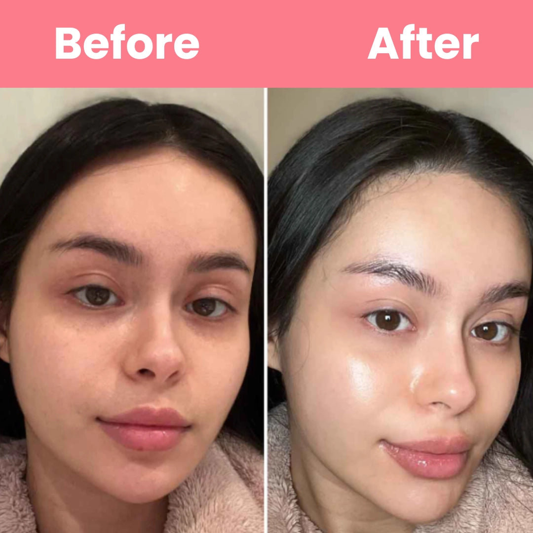 HOYGI™ Collagen Peal off Mask