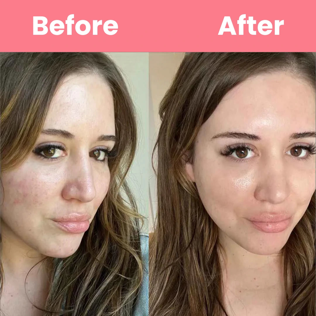 HOYGI™ Collagen Peal off Mask