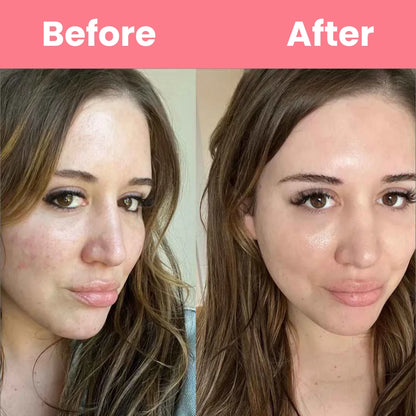 HOYGI™ Collagen Peal off Mask