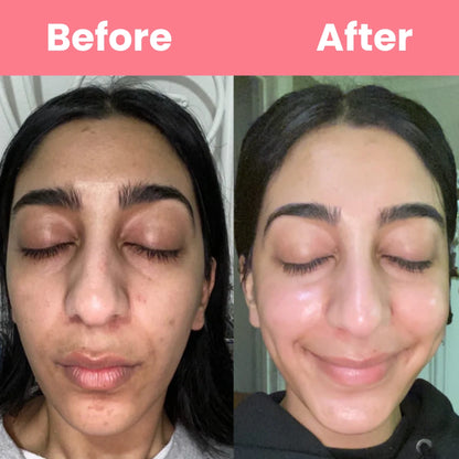 HOYGI™ Collagen Peal off Mask