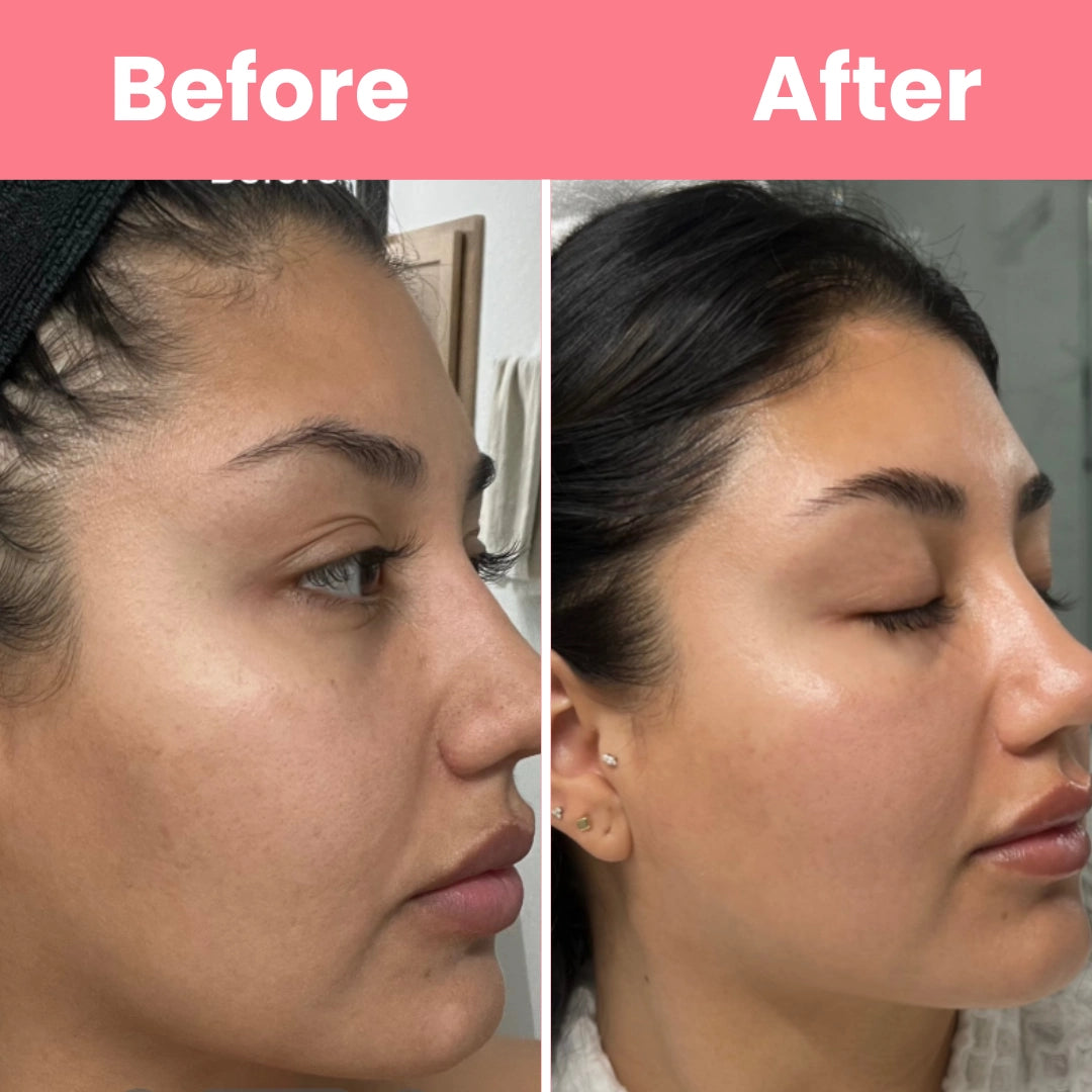 HOYGI™ Collagen Peal off Mask