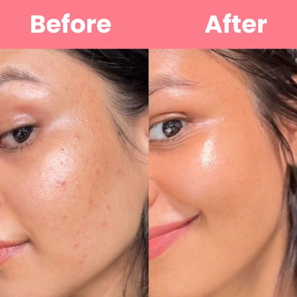 HOYGI™ Collagen Peal off Mask