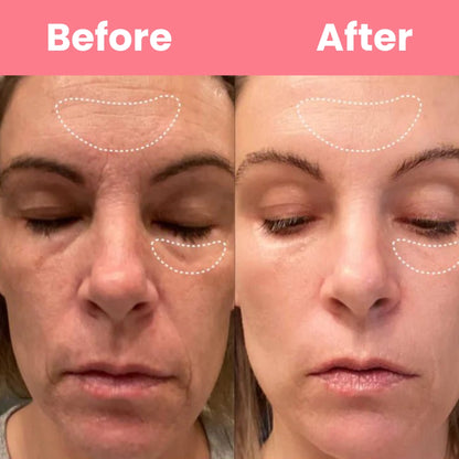 HOYGI™ Collagen Peal off Mask