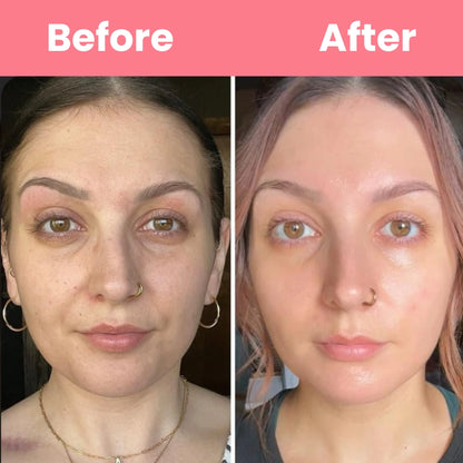 HOYGI™ Collagen Peal off Mask