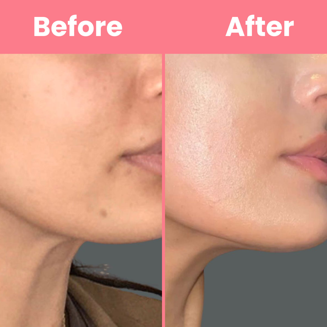 HOYGI™ Collagen Peal off Mask